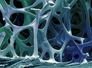 Prints of Bird bone tissue. Coloured scanning electron micrograph (SEM) of cancellous (spongy) bone from a robin Images Dated 2009 June: Cancellous Bone Tissue Print