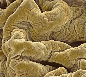 Bladder lining, SEM Bladder lining, SEM