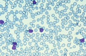 White Blood Cell Function Prints: Blood cells, light micrograph