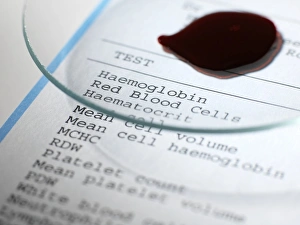 Blood Test Results Prints: Blood test