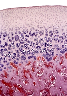 Bone growth, light micrograph Bone growth, light micrograph