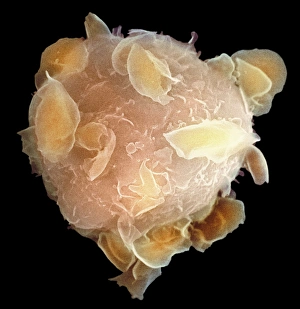 Prints of Bone marrow stem cell, coloured scanning electron micrograph (SEM). This cell is known as a multipotential stem cell because it can form the precursors to every type of blood cell Images Dated 2008 February: Bone Marrow Stem Cell Print