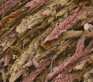 Prints of Spongy bone. Coloured scanning electron micrograph (SEM) of freeze-fractured spongy bone tissue. It shows the matrix of collagen and calcium crystals that form the structure of bone tissue Images Dated 2001 October: Spongy Bone Print