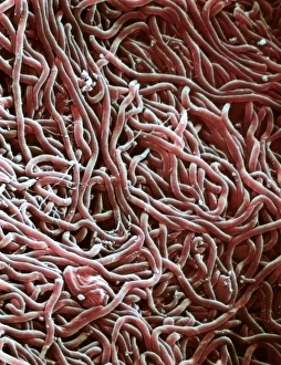 Coloured SEM Micrograph Prints: Borrelia bacteria, SEM