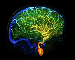 Brain blood vessels, 3D angiogram C007/1981 Brain blood vessels, 3D angiogram C007/1981