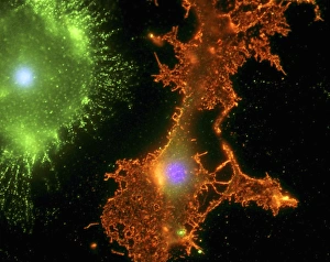 Brain cells in culture, light micrograph Brain cells in culture, light micrograph