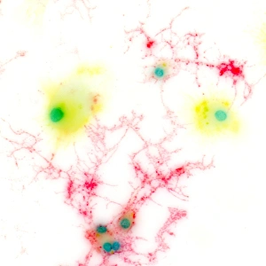 Images Dated 3rd August 2011: Activated Microglial Cells and Oligodendrocytes Print