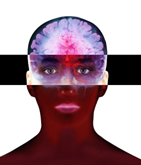 Nervous System Diagrams Prints: Brain scan