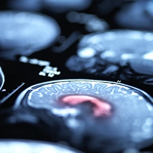 Cerebral Cortex Structure Prints: Brain scans