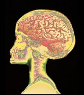 Brain superimposed on colour X-ray of human skull Brain superimposed on colour X-ray of human skull