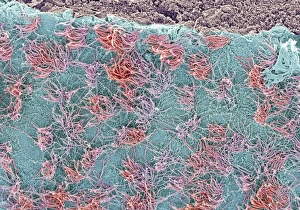 Brain Surface Print, SEM Image