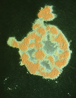 Staphylococcus Aureus Prints: Bursting of Staphylo- coccus bacterium