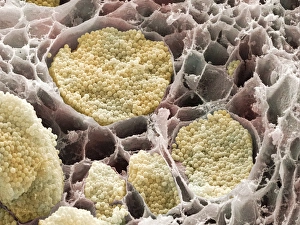 Prints of Cabbage root infection Images Dated 2004 June: Club Root Infection Print