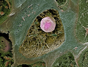 Prints of Cartilage cell. Coloured scanning electron micrograph (SEM) of a section through a chondrocyte cell (centre) in cartilage Images Dated 2003 December: SEM Print of Cartilage Cell in Lacuna