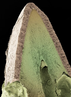 Cats tooth, SEM Cats tooth, SEM
