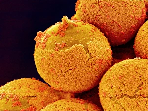 Pollen Grain Structure Prints: Cedar pollen, SEM