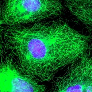 Prints of Cell division. Immunofluorescent light micrograph of a human epithelial cell (centre) during the interphase stage of mitosis Images Dated 2011 August: Human Epithelial Cell Division Print