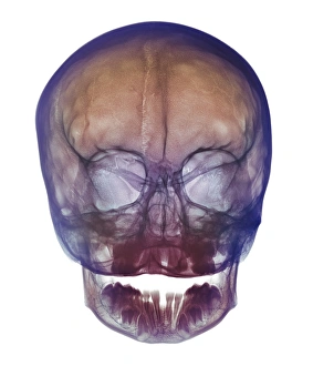 Childs skull Childs skull