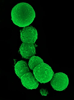 SEM Images Of Bacteria Prints: Chlamydia bacteria, SEM