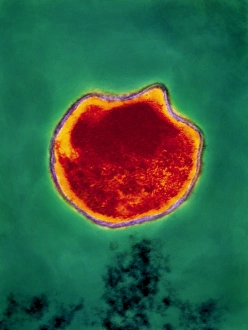 Images Dated 1994: Chlamydia pneumoniae Bacterium Print
