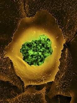 SEM Images Of Bacteria Prints: Chlamydia, SEM