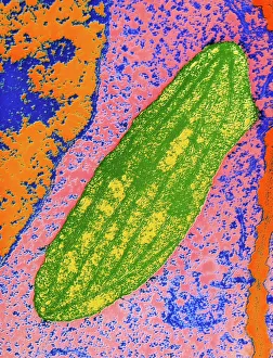 Chloroplast in cell of pea plant Chloroplast in cell of pea plant