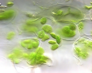 Photosynthesis Process Prints: Chloroplasts, light micrograph