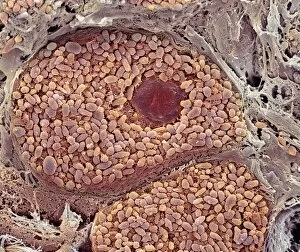 Images Dated 9th March 2005: Choroid layer of the eye, SEM