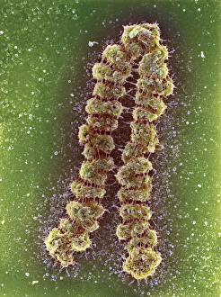Condensed Chromosome SEM Print