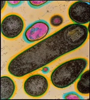 Food Poisoning Causes Prints: Clostridium bacteria