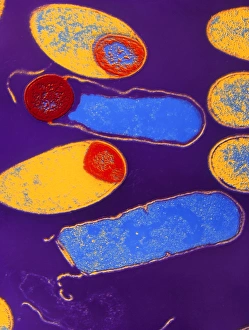 Clostridium botulinum bacteria with spores Clostridium botulinum bacteria with spores