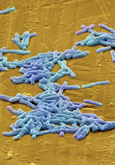 SEM Prints: SEM Print of Clostridium difficile bacteria, coloured