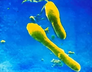 Images Dated 7th April 1986: Clostridium tetani bacteria