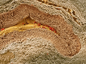 Collapsed ovarian follicle, SEM Collapsed ovarian follicle, SEM