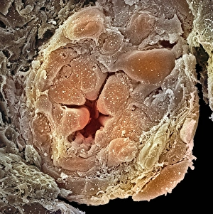 Collecting duct from a kidney, SEM Collecting duct from a kidney, SEM