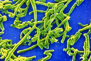 Colour SEM of Corynebacterium diphtheria Colour SEM of Corynebacterium diphtheria
