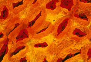 Colour SEM of the stomach mucosa & gastric pits Colour SEM of the stomach mucosa & gastric pits