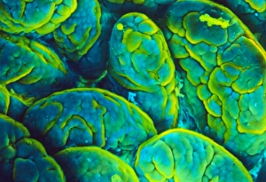 Colour SEM of villi in the small intestine Colour SEM of villi in the small intestine