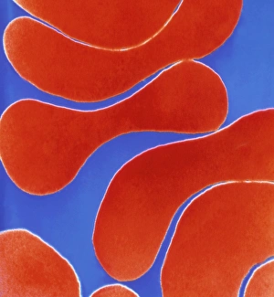 Colour TEM of red blood cells, rouleau formation Colour TEM of red blood cells, rouleau formation