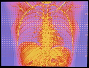 Coloured CT scan showing the lungs and heart Coloured CT scan showing the lungs and heart