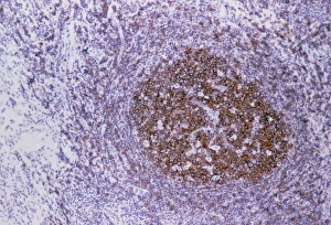 Coloured LM of a follicle of a human lymph node Coloured LM of a follicle of a human lymph node