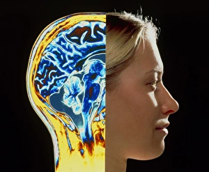Coloured MRI scan of brain superimposed on head Coloured MRI scan of brain superimposed on head