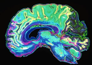 Coloured sagittal slice through a healthy brain Coloured sagittal slice through a healthy brain