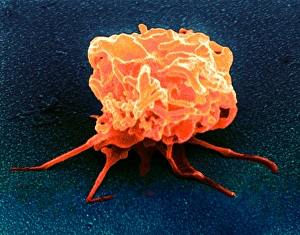 Coloured SEM of an activated blood platelet Coloured SEM of an activated blood platelet