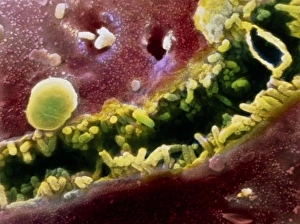 Coloured SEM of a bile canaliculus in the liver Coloured SEM of a bile canaliculus in the liver