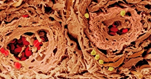 Coloured SEM of blood vessels in the skin Coloured SEM of blood vessels in the skin