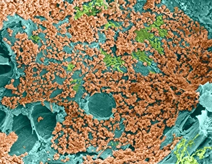 Coloured SEM of bone marrow in spongy bone Coloured SEM of bone marrow in spongy bone