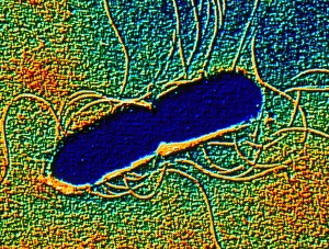 Coloured SEM of Clostridium botulinum Coloured SEM of Clostridium botulinum