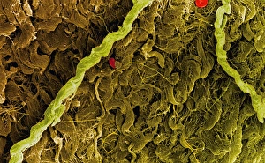 Coloured SEM of collagen connective tissue fibres Coloured SEM of collagen connective tissue fibres