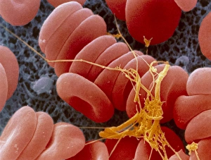 Coloured SEM of an early blood clot forming Coloured SEM of an early blood clot forming